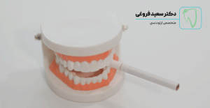 سیگار و تأثیر آن بر درمان ارتودنسی فروغی