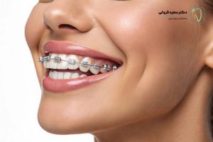 آیا ارتودنسی عوارض دارد؟