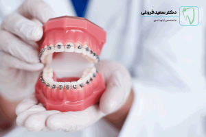 ارتودنسی برای لبخند فروغی