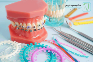 آیا ارتودنسی صدا را تغییر میدهد؟ فروغی
