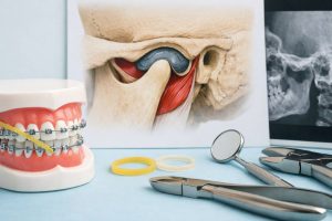 ارزیابی اثرات نیروی الاستیک بین فکها (Intermaxillary Elastics) بر دینامیک مفصل فکی–گیجگاهی (TMJ)